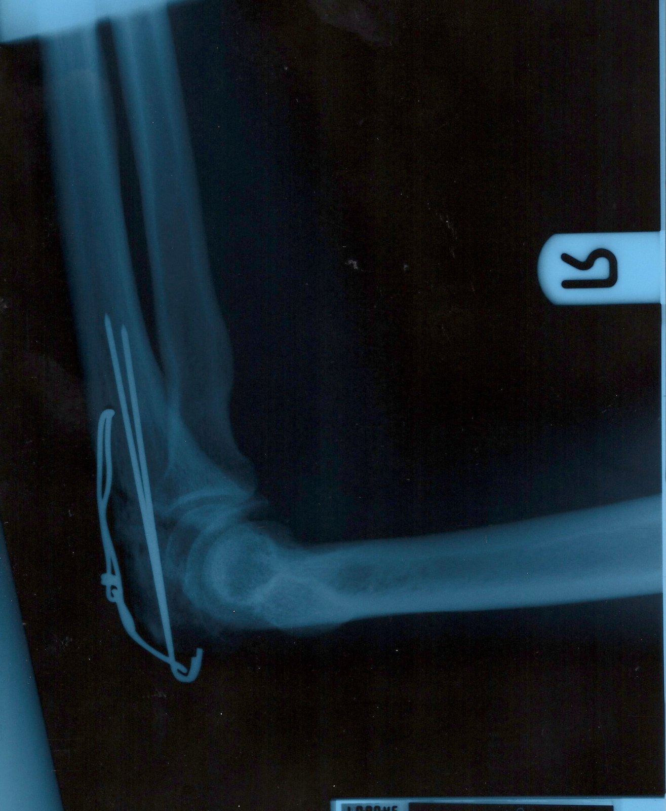 Elbow 1.jpg