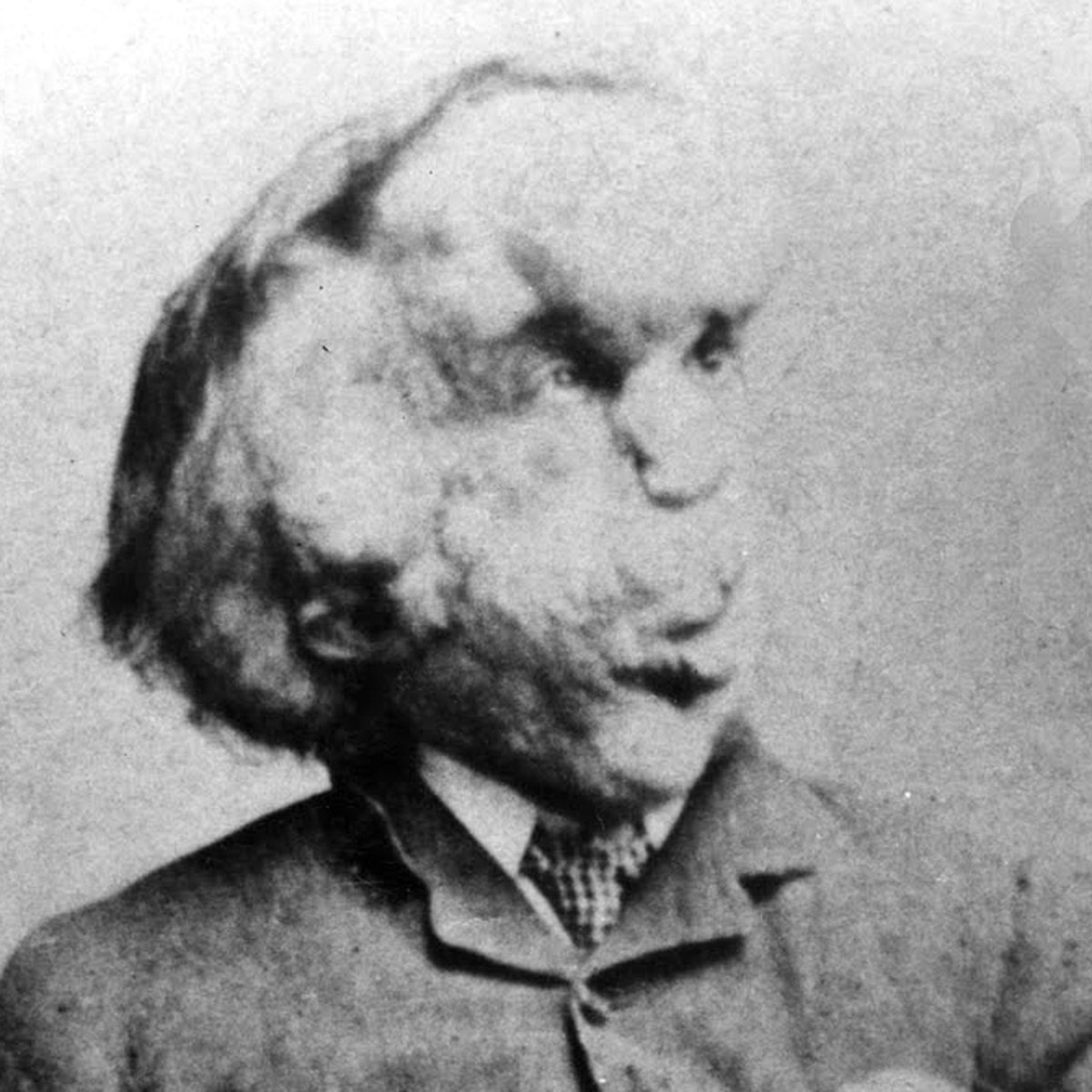 joseph-merrick-carte-de-visite-1889-600x600jpg.jpg