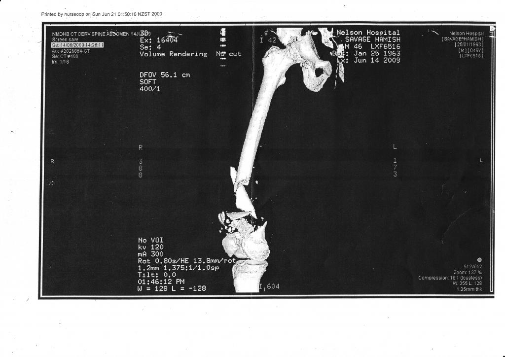 metal & bones_0001.jpg