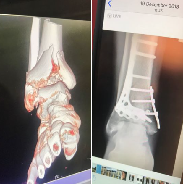 Screen Shot 2019-02-05 at 17.58.46.png