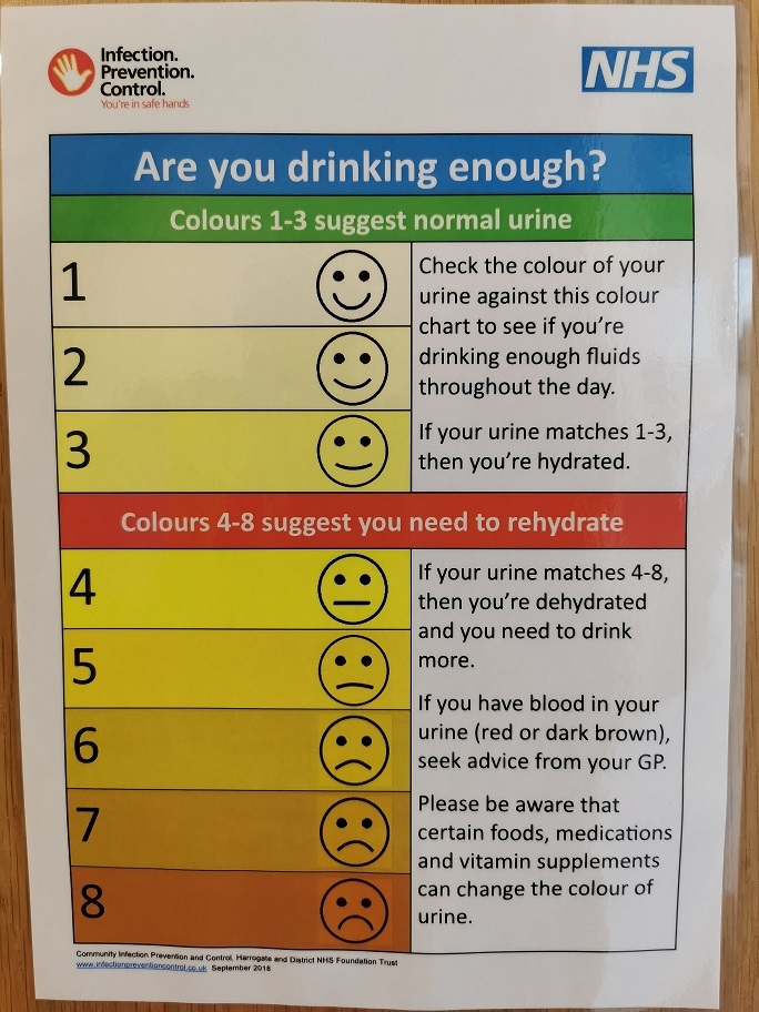 Urine colour