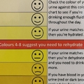 Urine colour